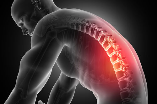 Chronic Back Pain